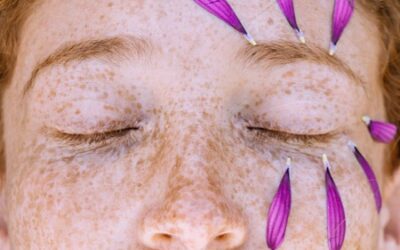 Guide Complet sur l’Épilation du Visage pour Femmes à Strasbourg